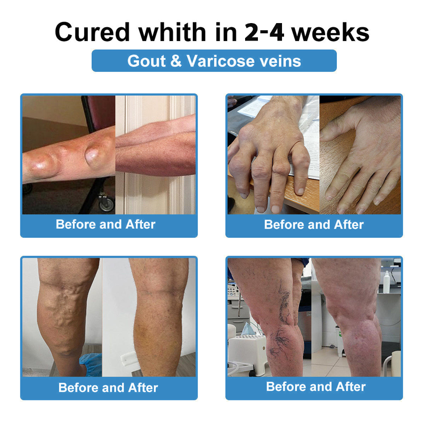 [New Year Special Offer] CureVivo® Pain Relief& Repair Lotion🎅For Muscle, Joint & Nerve Pain
