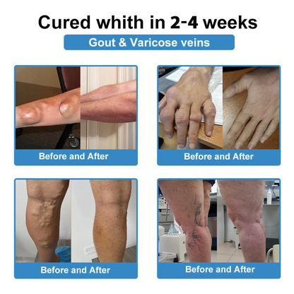 [New Year Special Offer] CureVivo® Pain Relief& Repair Lotion🎅For Muscle, Joint & Nerve Pain