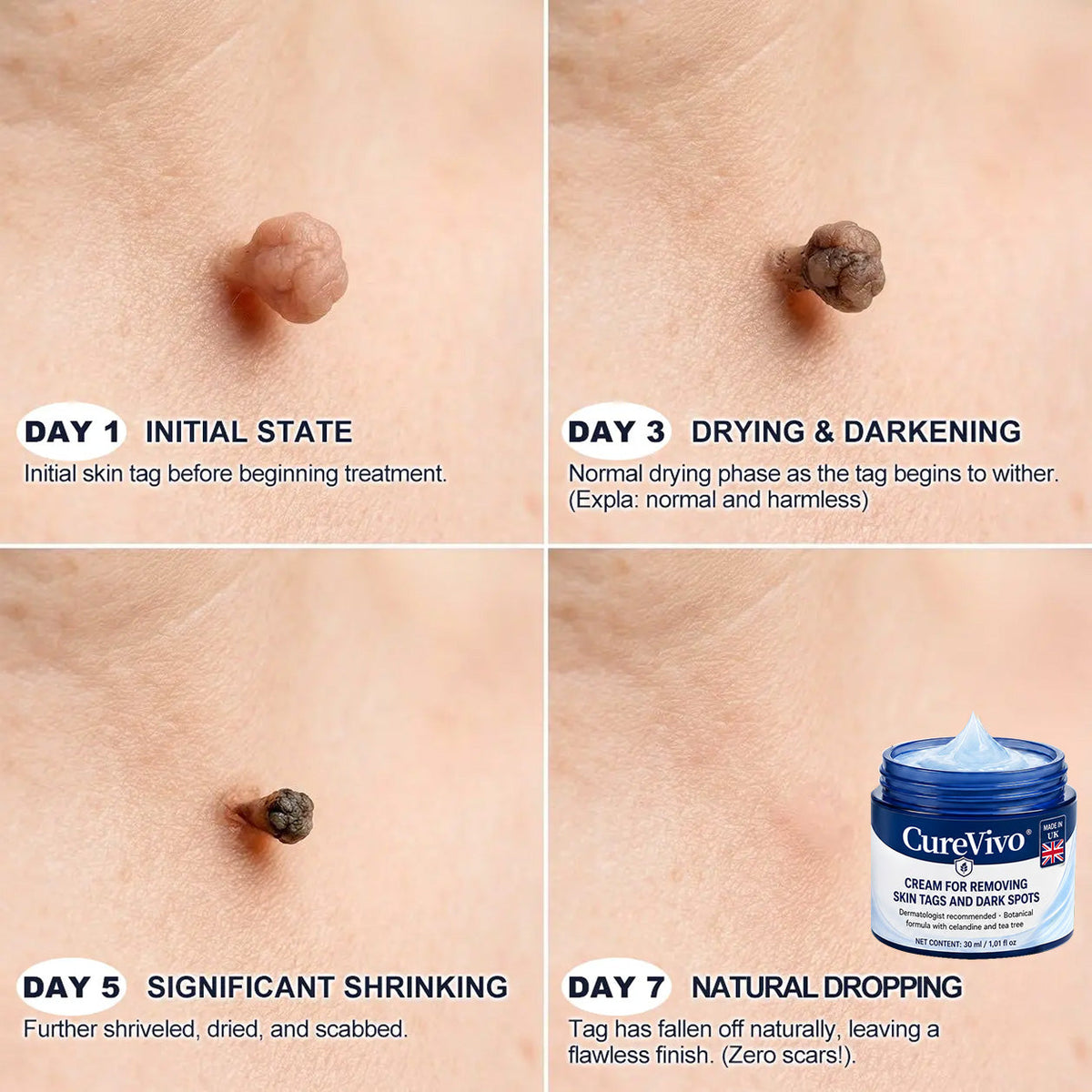 𝟓𝟎% 𝐎𝐅𝐅 | 𝐎𝐅𝐅𝐈𝐂𝐈𝐀𝐋 𝐂𝐔𝐑𝐄𝐕𝐈𝐕𝐎® 𝐒𝐓𝐎𝐑𝐄