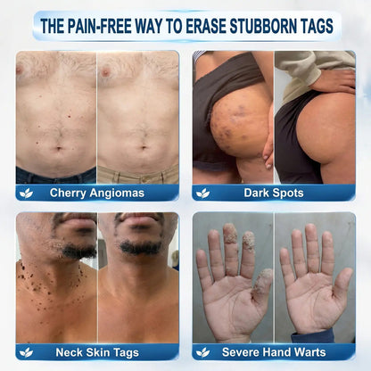 𝟓𝟎% 𝐎𝐅𝐅 | 𝐎𝐅𝐅𝐈𝐂𝐈𝐀𝐋 𝐂𝐔𝐑𝐄𝐕𝐈𝐕𝐎® 𝐒𝐓𝐎𝐑𝐄