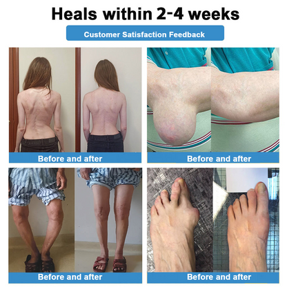 [New Year Special Offer] CureVivo® Pain Relief& Repair Lotion👩‍⚕️For Muscle, Joint & Nerve Pain