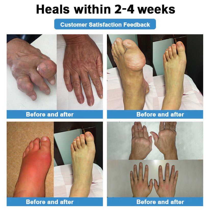 [New Year Special Offer] CureVivo® Pain Relief& Repair Lotion👩‍⚕️For Muscle, Joint & Nerve Pain