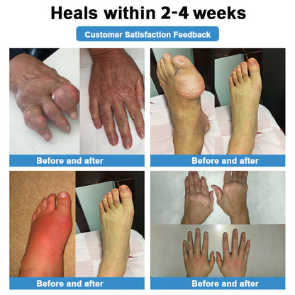 [New Year Special Offer] CureVivo® Pain Relief& Repair Lotion👩‍⚕️For Muscle, Joint & Nerve Pain