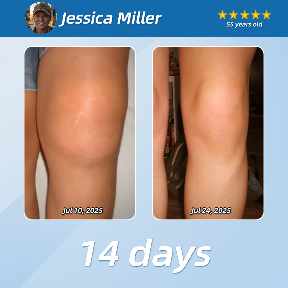 [New Year Special Offer] CureVivo® Pain Relief& Repair Lotion🥇For Muscle, Joint & Nerve Pain