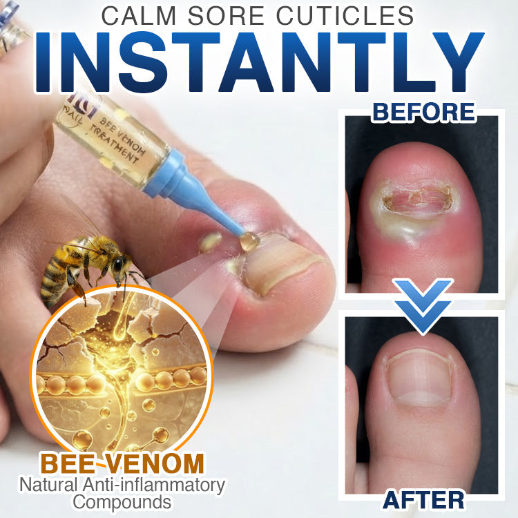 🇬🇧 𝐓𝐫𝐢𝐥𝐮𝐦𝐢𝐚® Fungi Free Bee Venom Nail Treatment 🐝