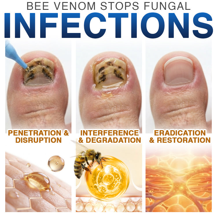 🇬🇧 𝐓𝐫𝐢𝐥𝐮𝐦𝐢𝐚® Fungi Free Bee Venom Nail Treatment 🐝