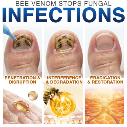 🇬🇧 𝐓𝐫𝐢𝐥𝐮𝐦𝐢𝐚® Fungi Free Bee Venom Nail Treatment 🐝