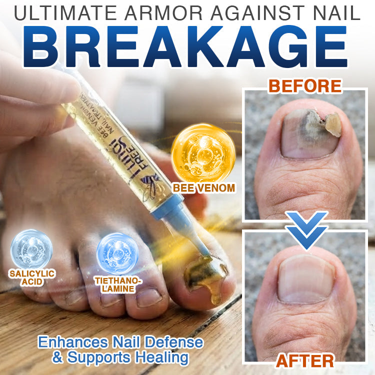 🇬🇧 𝐓𝐫𝐢𝐥𝐮𝐦𝐢𝐚® Fungi Free Bee Venom Nail Treatment 🐝