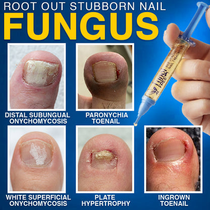 🇬🇧 𝐓𝐫𝐢𝐥𝐮𝐦𝐢𝐚® Fungi Free Bee Venom Nail Treatment 🐝